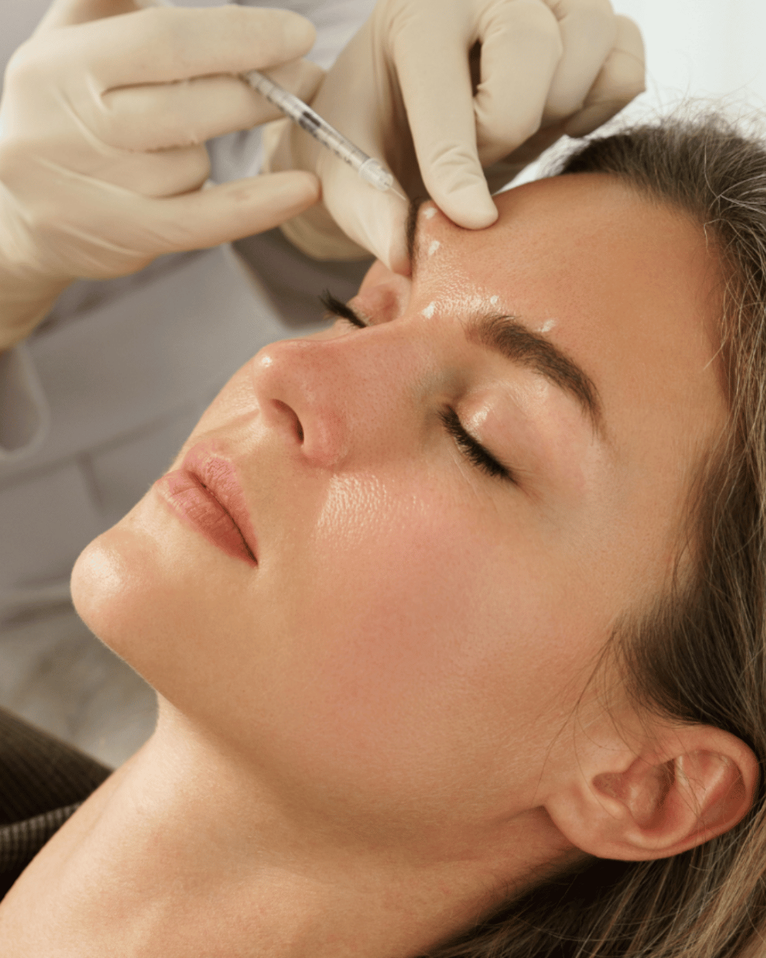 Anti-Wrinkle injection eye brow lift