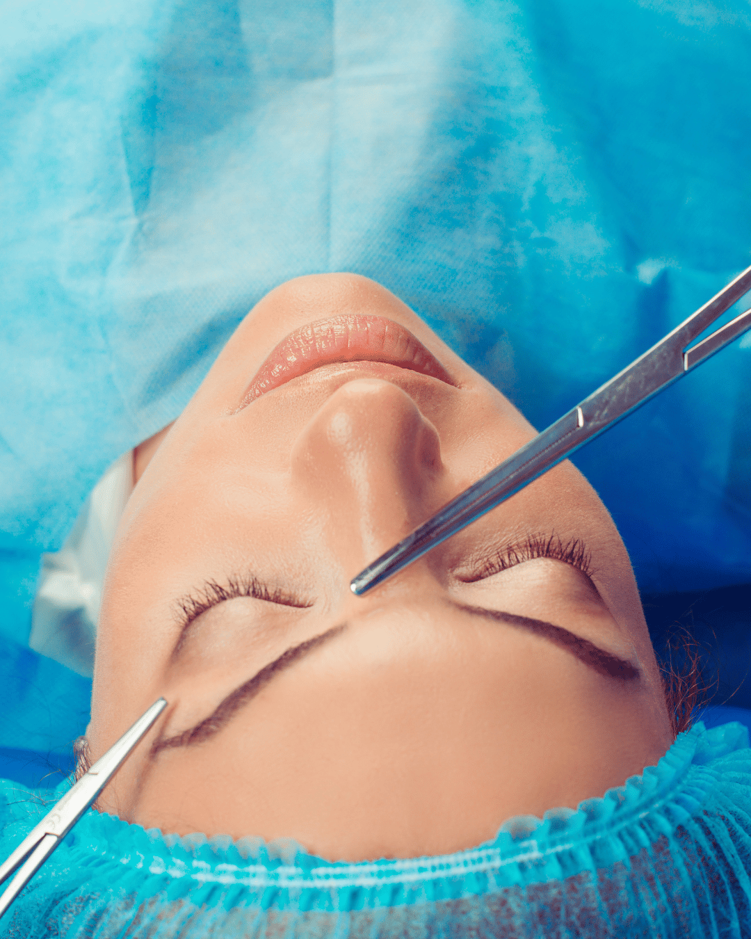 blepharoplasty surgery measuring 2