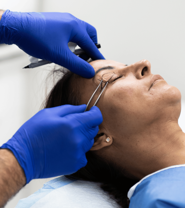 dr ayad blepharoplasty surgery in bicester