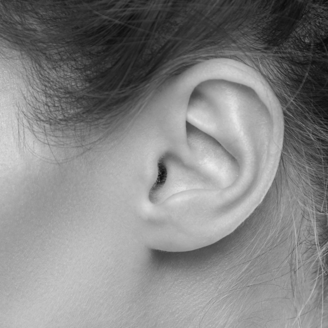 ear for otoplasty mono