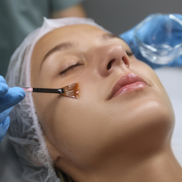 Dermaceutic Peel