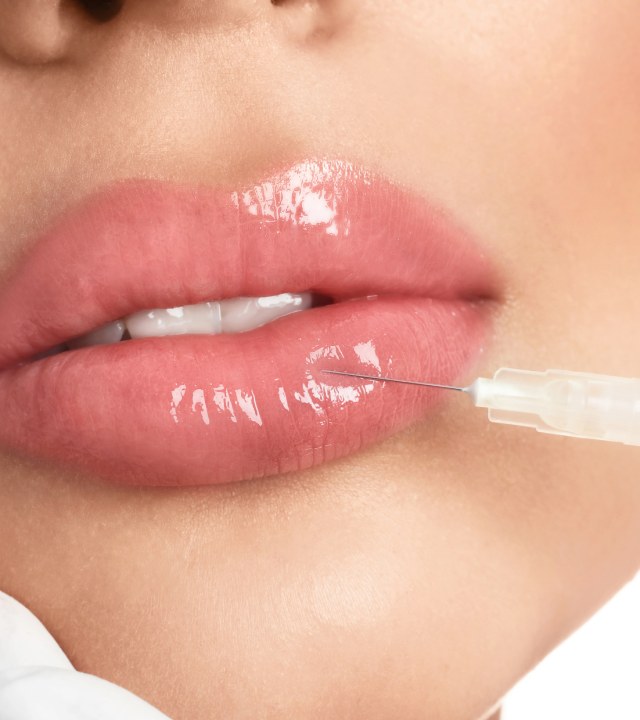 Lip filler injectable cover image