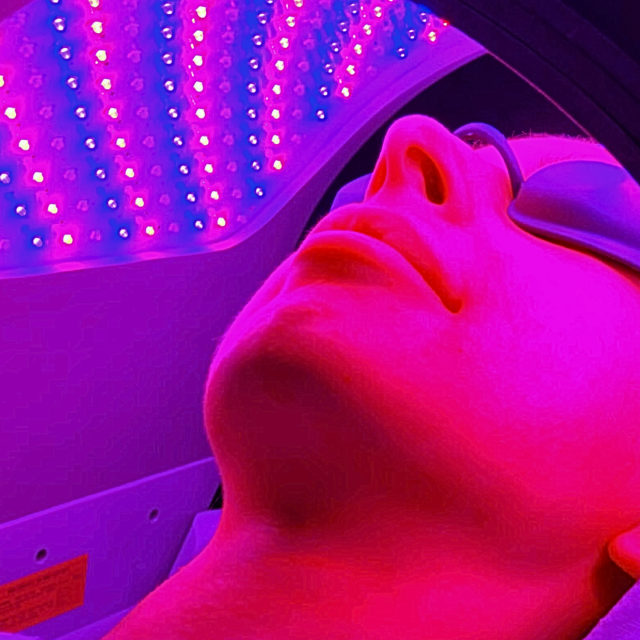 Dermalux LED Treatment