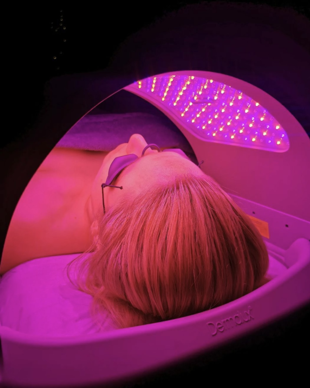 dermalux led light facial