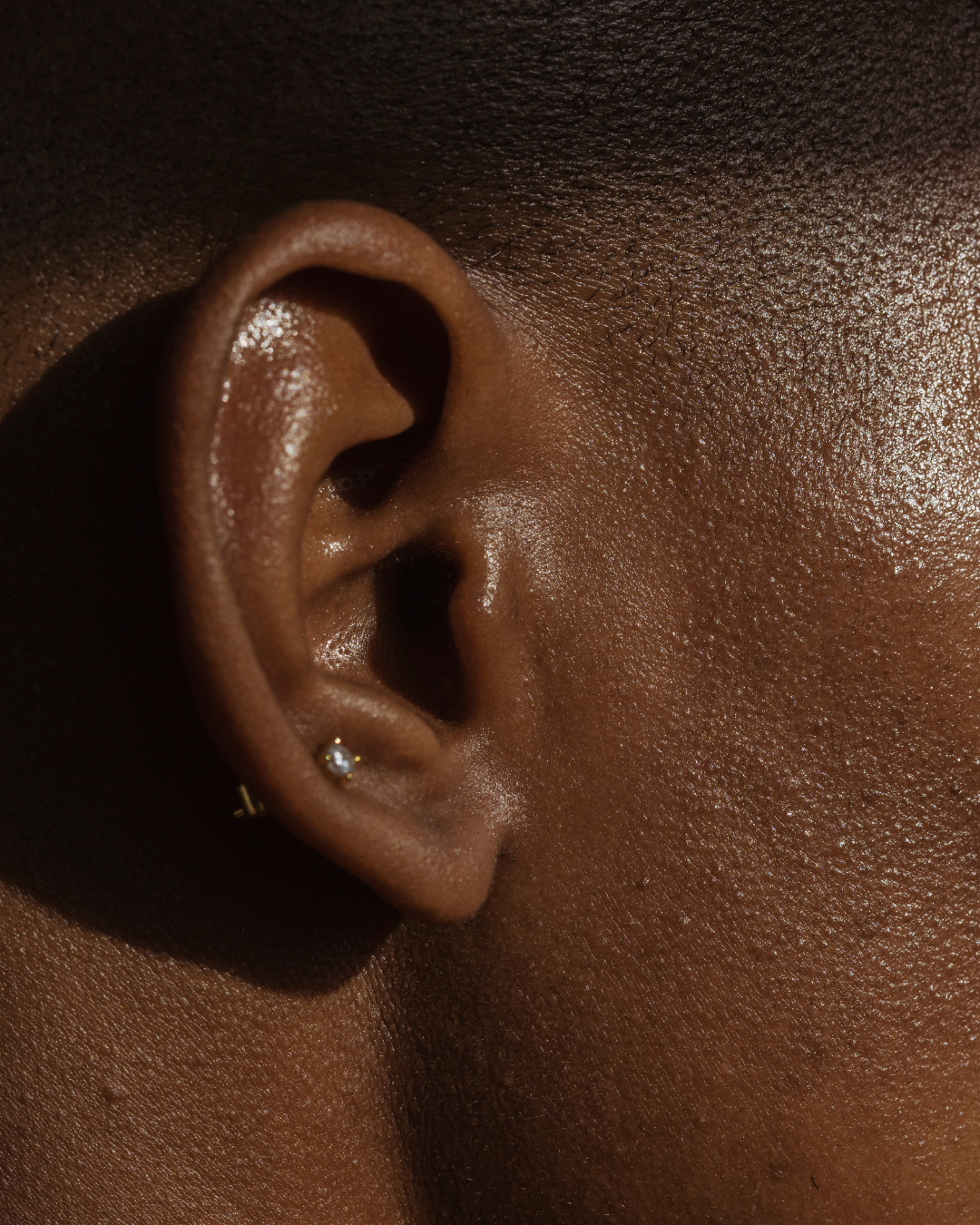 ear pinned image