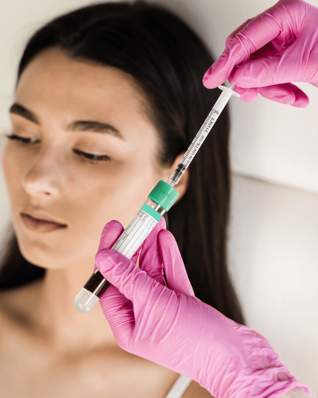 prp facial treatment