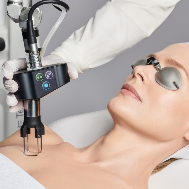 CO2 Laser Resurfacing