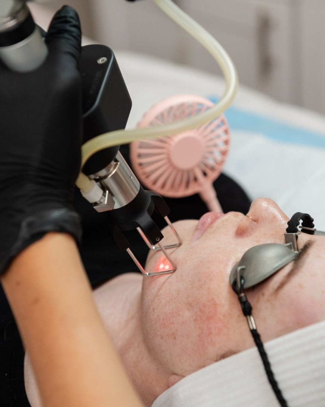 woman getting co2 treatment