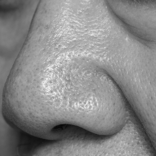 pores close up mono