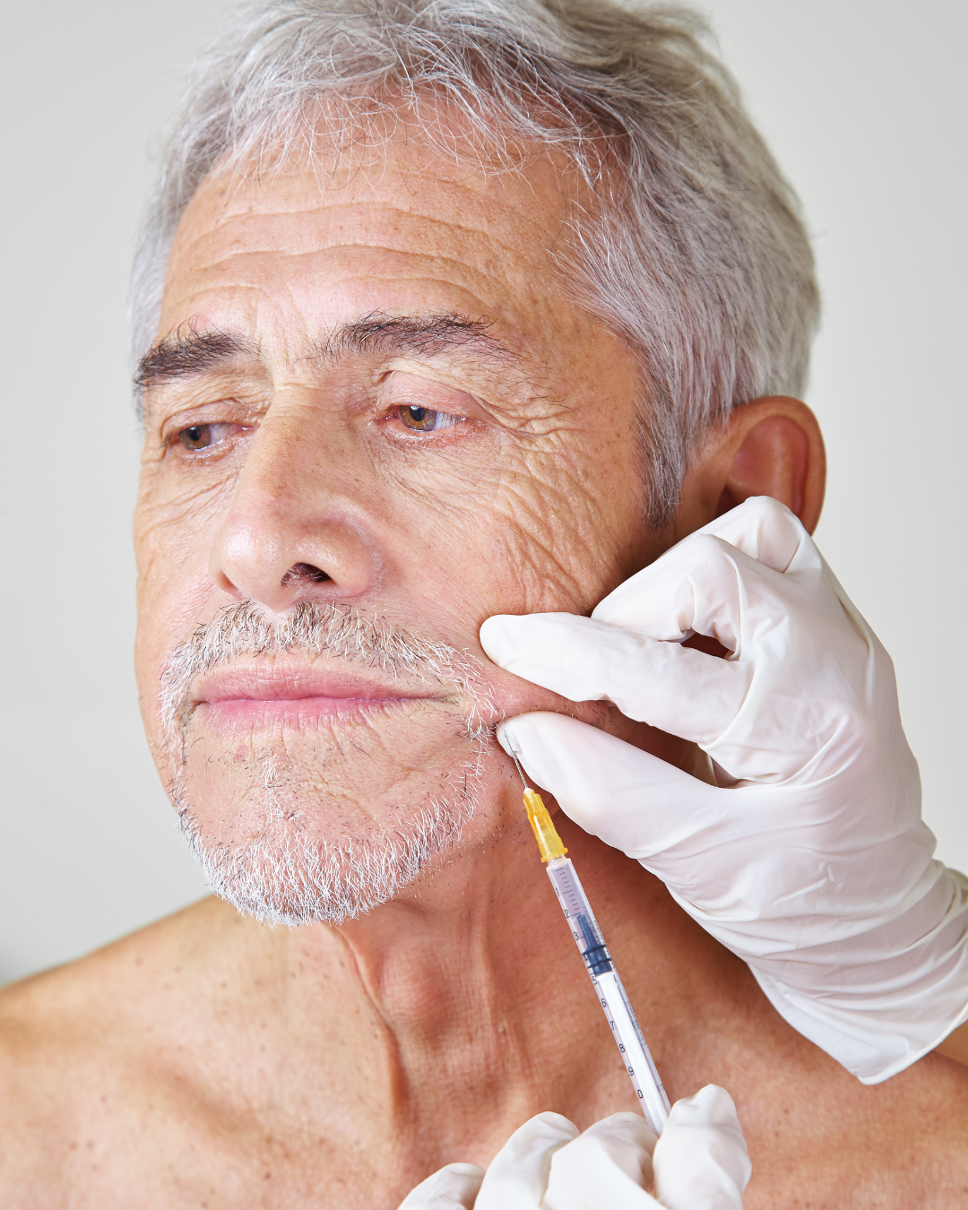 mens masseter botox